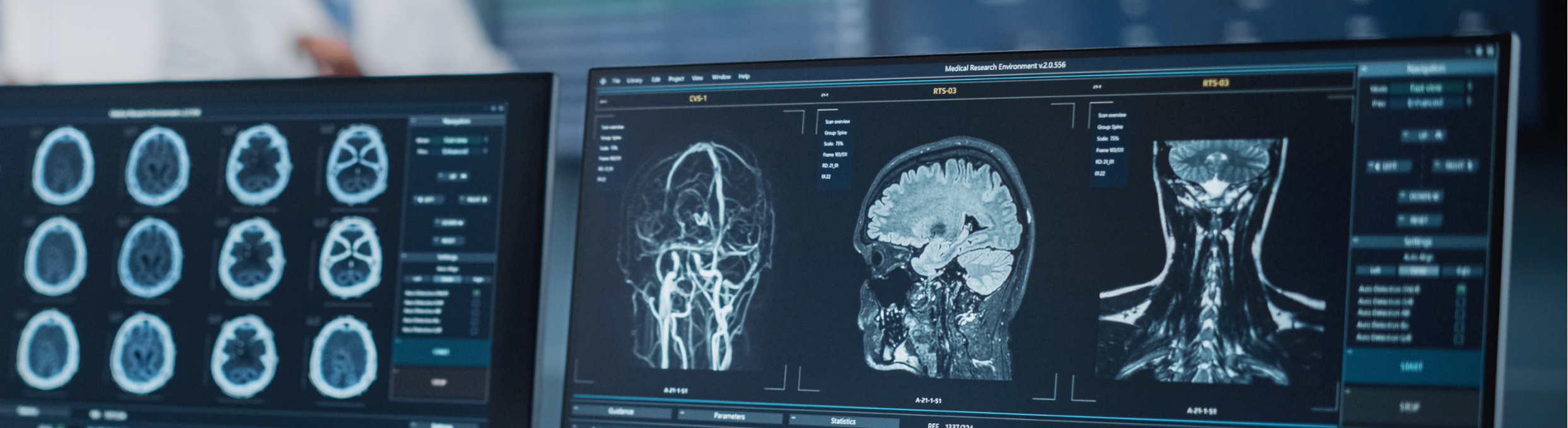 Photo of monitors with brain scans